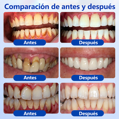🍟💖𝑮𝒍𝒊𝒎𝒎𝒆𝒓𝒍𝒚® 𝑮𝒖𝒎𝑹𝒆𝒗𝒊𝒗𝒆 𝑮𝒆𝒍 𝑹𝒆𝒑𝒂𝒓𝒂𝒅𝒐𝒓 𝑷𝒆𝒓𝒊𝒐𝒅𝒐𝒏𝒕𝒂𝒍