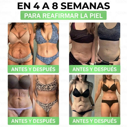 𝑳𝒖𝒙𝒂𝒓𝒊𝒔𝒆®⏲️ Moringa & Berberina 10 en 1 Parche Avanzado de Microagujas Nano (Uso diario, cambios visibles en 7 días) 👩‍⚕️ Obesidad, Diabetes, Apnea del Sueño y Problemas Articulares