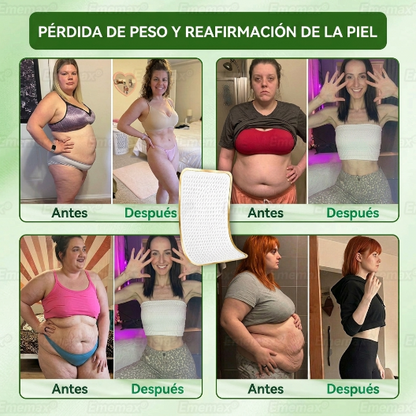 🔴[[𝐍𝐨𝐯𝐞𝐝𝐚𝐝 𝐲 𝐦𝐞𝐣𝐨𝐫𝐚 𝟐𝟎𝟐𝟔: ¡𝟖𝟎% 𝐝𝐞 𝐝𝐞𝐬𝐜𝐮𝐞𝐧𝐭𝐨!] ✅ 𝐄𝐦𝐞𝐦𝐚𝐱®𝐏𝐀𝐑𝐂𝐇𝐄 𝐍𝐀𝐍𝐎 𝐌𝐈𝐂𝐑𝐎𝐍𝐄𝐄𝐃𝐋𝐄 𝐀𝐃𝐄𝐋𝐆𝐀𝐙𝐀𝐍𝐓𝐄 𝐃𝐑𝐄𝐍𝐀𝐉𝐄 𝐋𝐈𝐍𝐅𝐀𝐓𝐈𝐂𝐎 — 𝐀𝐝𝐞𝐦á𝐬: 𝐚𝐥𝐢𝐯𝐢𝐨 𝐚𝐫𝐭𝐢𝐜𝐮𝐥𝐚𝐫, 𝐦𝐞𝐣𝐨𝐫 𝐝𝐞𝐬𝐜𝐚𝐧𝐬𝐨 𝐲 𝐜𝐥𝐚𝐫𝐢𝐝𝐚𝐝 𝐦𝐞𝐧𝐭𝐚𝐥.