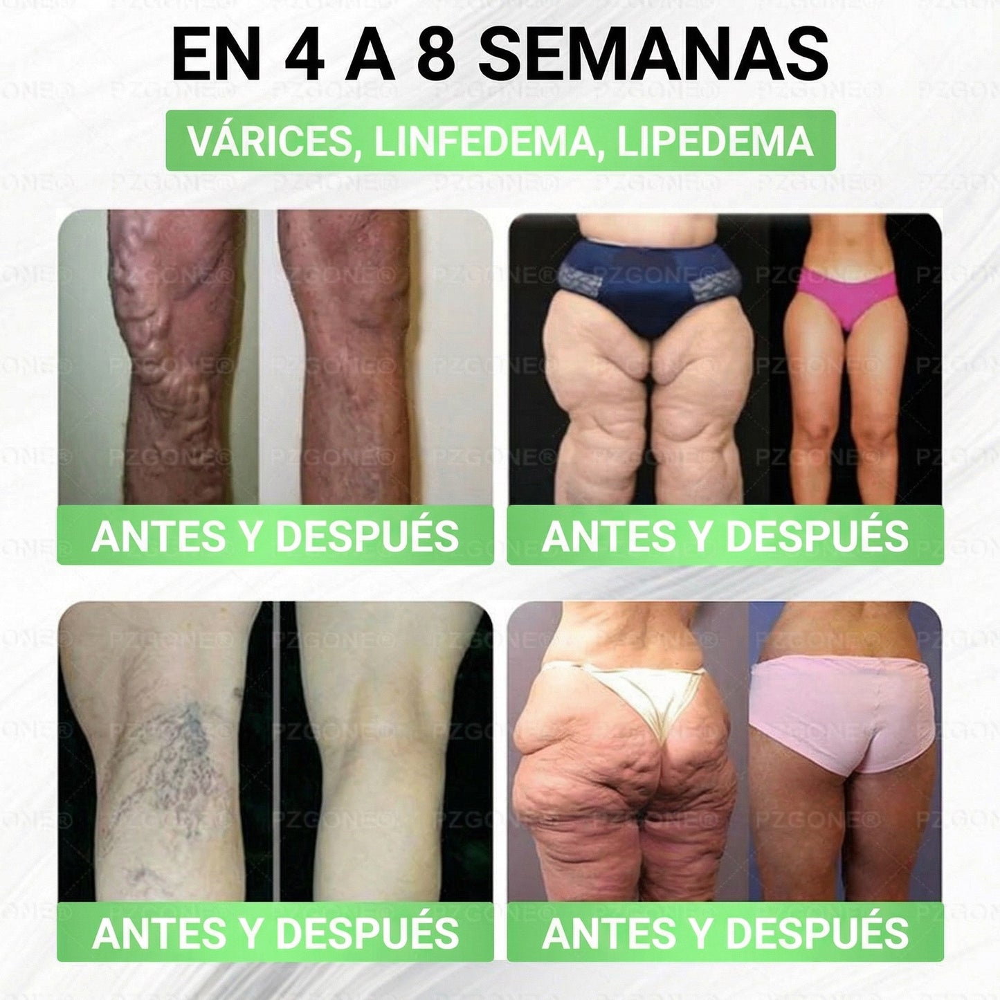 𝑳𝒖𝒙𝒂𝒓𝒊𝒔𝒆®⏲️ Moringa & Berberina 10 en 1 Parche Avanzado de Microagujas Nano (Uso diario, cambios visibles en 7 días) 👩‍⚕️ Obesidad, Diabetes, Apnea del Sueño y Problemas Articulares
