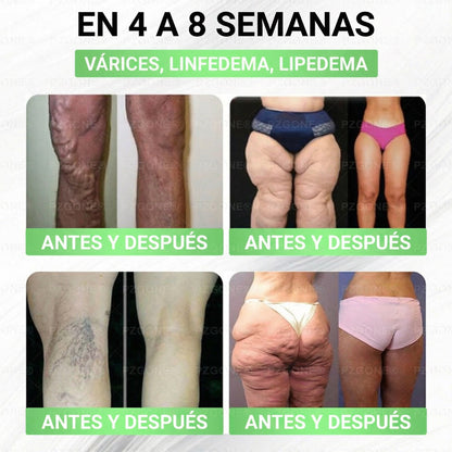 𝑳𝒖𝒙𝒂𝒓𝒊𝒔𝒆®⏲️ Moringa & Berberina 10 en 1 Parche Avanzado de Microagujas Nano (Uso diario, cambios visibles en 7 días) 👩‍⚕️ Obesidad, Diabetes, Apnea del Sueño y Problemas Articulares