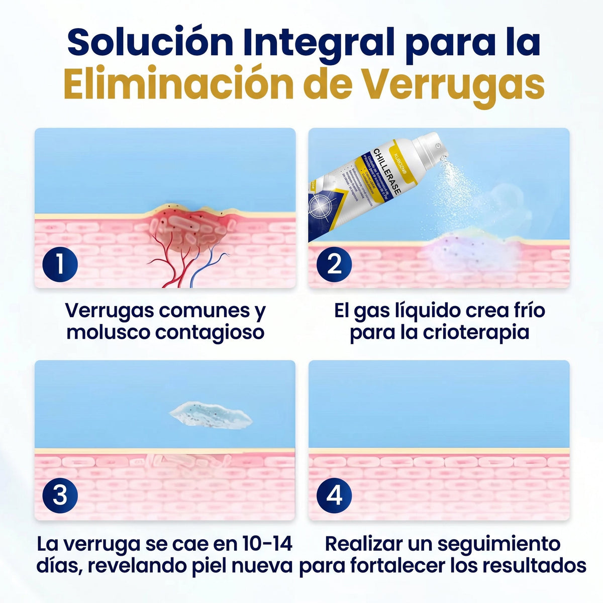 🇸 KUBOZN®ChillErase Spray de Renovación contra Protuberancias