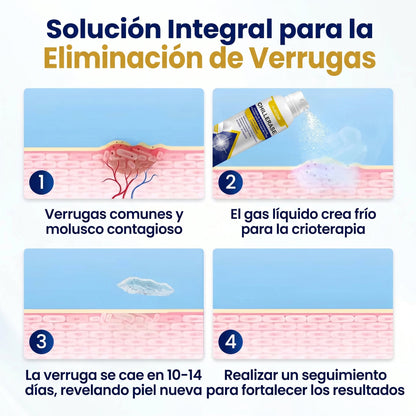🇸 KUBOZN®ChillErase Spray de Renovación contra Protuberancias