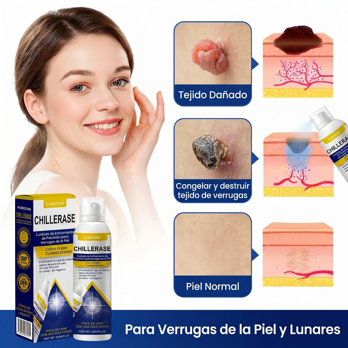 🇸 KUBOZN®ChillErase Spray de Renovación contra Protuberancias