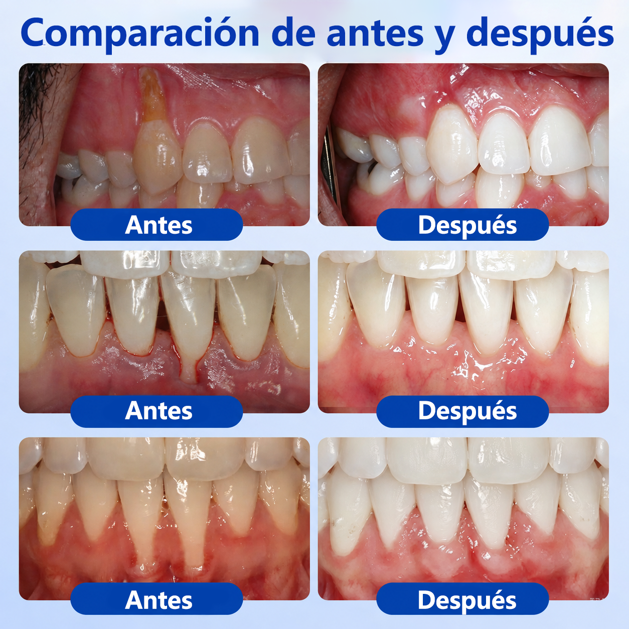 🍟💖𝑮𝒍𝒊𝒎𝒎𝒆𝒓𝒍𝒚® 𝑮𝒖𝒎𝑹𝒆𝒗𝒊𝒗𝒆 𝑮𝒆𝒍 𝑹𝒆𝒑𝒂𝒓𝒂𝒅𝒐𝒓 𝑷𝒆𝒓𝒊𝒐𝒅𝒐𝒏𝒕𝒂𝒍