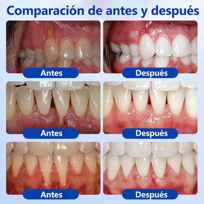 🍟💖𝑮𝒍𝒊𝒎𝒎𝒆𝒓𝒍𝒚® 𝑮𝒖𝒎𝑹𝒆𝒗𝒊𝒗𝒆 𝑮𝒆𝒍 𝑹𝒆𝒑𝒂𝒓𝒂𝒅𝒐𝒓 𝑷𝒆𝒓𝒊𝒐𝒅𝒐𝒏𝒕𝒂𝒍